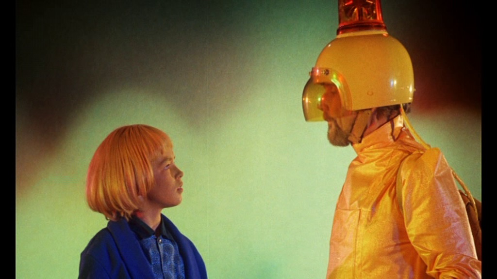 1972 boy who turned yellow