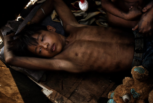 Mio Cade. Homeless boy Manila 21st
